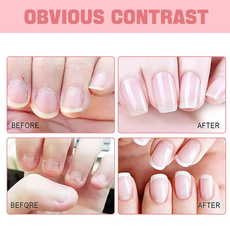 Nail and Cuticle Oil Nail Care, Moisturizing, Strengthening.